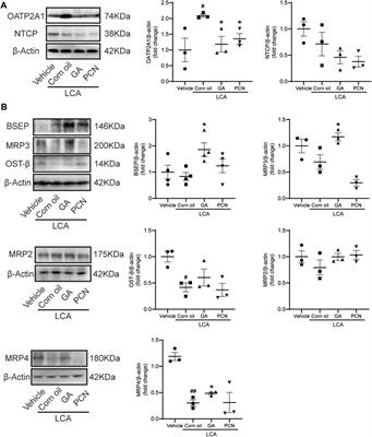 Hepatoprotective Effects of Glycyrrhetinic Acid on Lithocholic Acid-Induced Cholestatic Liver Injury Through Choleretic and Anti-Inflammatory Mechanisms